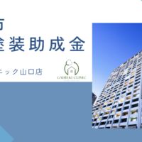 【2026年最新版】広島市で外壁塗装の助成金は終了？実際の施工事例も紹介！